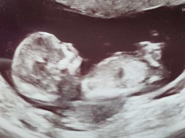 Due February 2022 (thread 2)