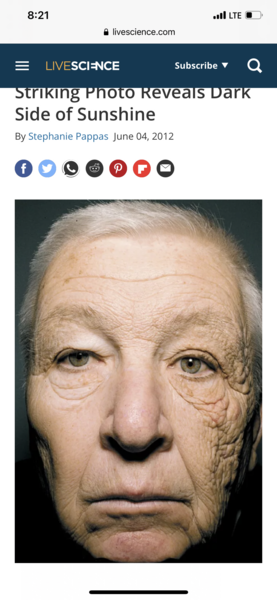 I look so old! What to do about my eyes?