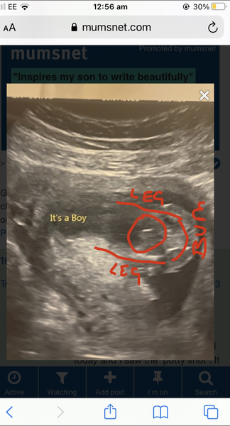 16 week gender scan confusion! Help!