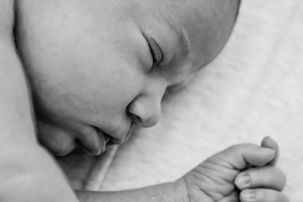 Short Nasal Bone - sign of Down Syndrome?