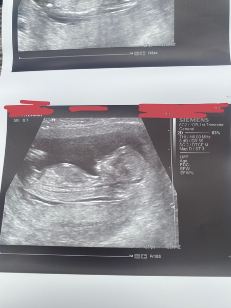 Confirmed baby boy?
