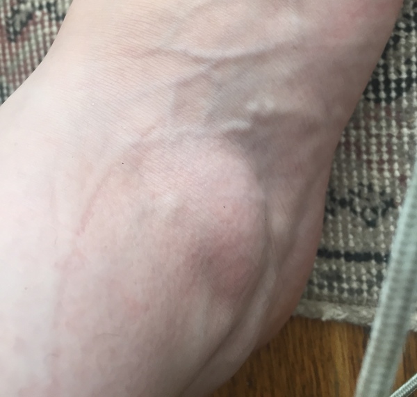 Does anyone know what this disgusting thing is please?