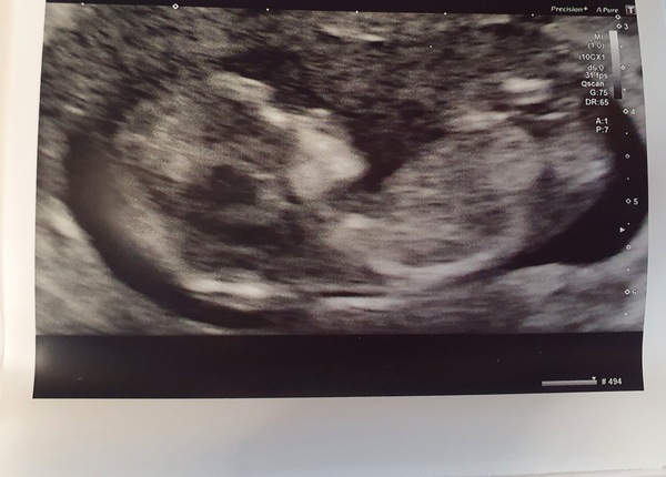 Any guesses on the gender??? 💙💖🍼