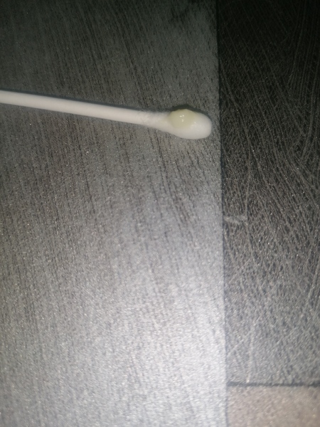 Is this normal discharge??