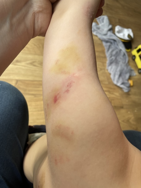 AIBU to not bite my child?