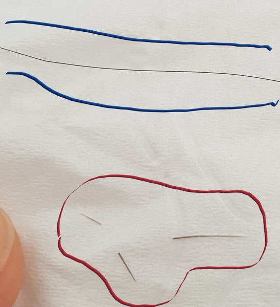 HELP! What kind of Parasite is this?
