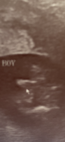 Cord or boy?