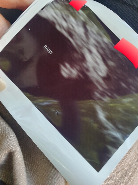 Support for Women who are TTC or Pregnant Following a Termination for Abnormalities- Thread 8