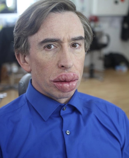 Lips - is this what people are aspiring to these days?