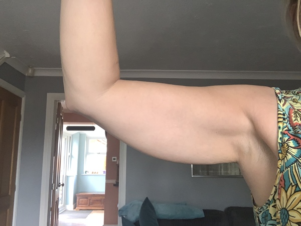 Upper arms look awful 😞