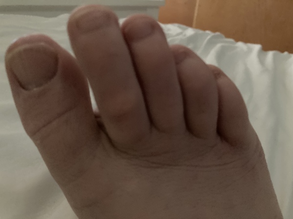 To ask what is this on my toe?
