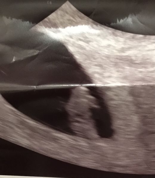 Does my scan look okay?