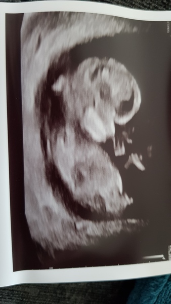 12 week scan - boy?