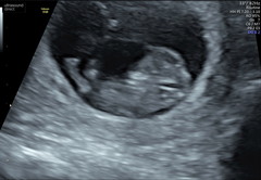 Can anyone guess baby's gender ?