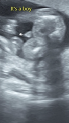 16 week gender scan confusion! Help!