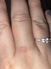 Is this psoriasis or eczema?