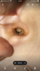 DD 4 waxy ears/pain/infection