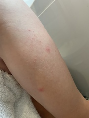 Red spots any idea?