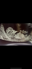 Boy or girl