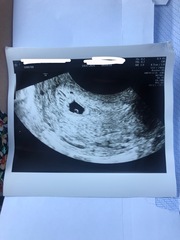 Due March 2022