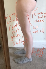 To think I might have lipedema? Anyone know anything about it?