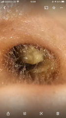 DD 4 waxy ears/pain/infection