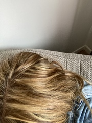 Hair gone wrong (with pics!)