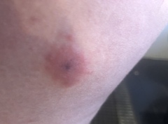 Why do my bites always go like this now?