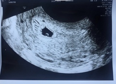Due March 2022