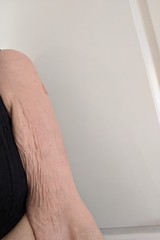 Upper arms look awful 😞