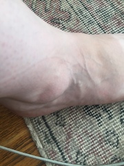 Does anyone know what this disgusting thing is please?