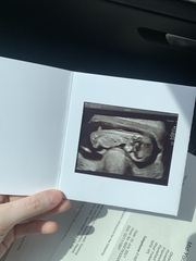 Due February 2022 (thread 2)