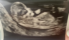 Boy or girl