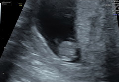 Can anyone guess baby's gender ?