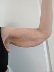 Upper arms look awful 😞
