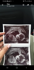 20 week Ultrasound!