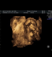 Nub/skull/theory help !2