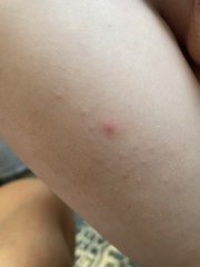 Red spots any idea?