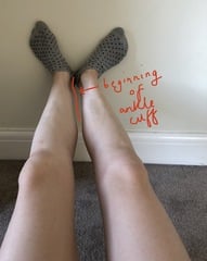 To think I might have lipedema? Anyone know anything about it?