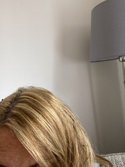 Hair gone wrong (with pics!)