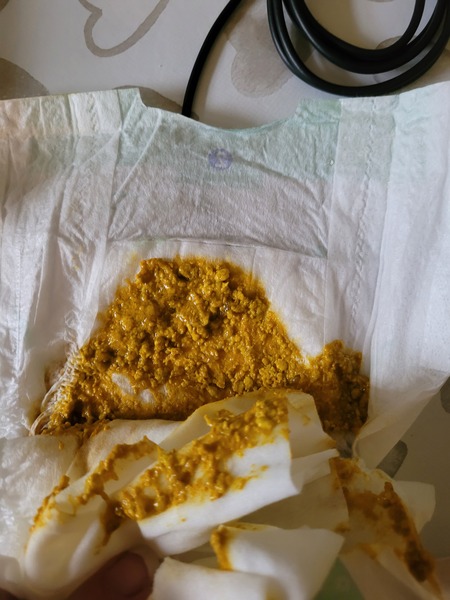 Is this diarrhoea? 1 MO poop