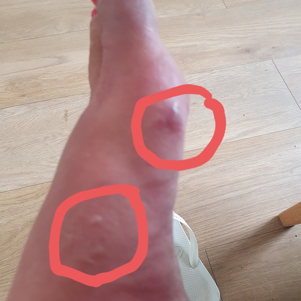Can anyone identify these bites? Pic included