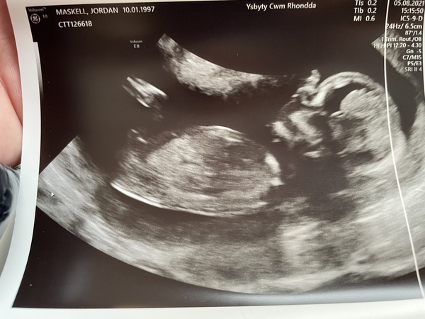 Gender guesses?