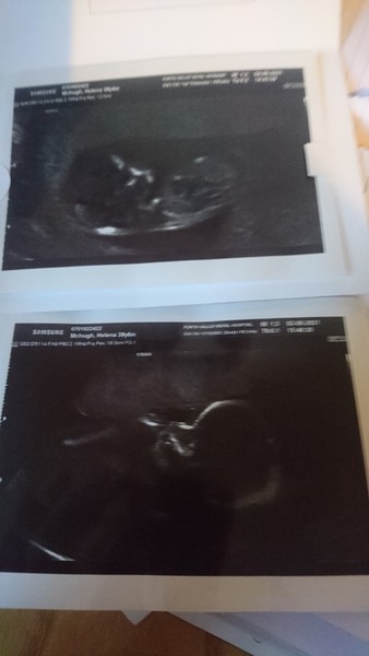 IVF Graduates due Late 2021/Early 2022