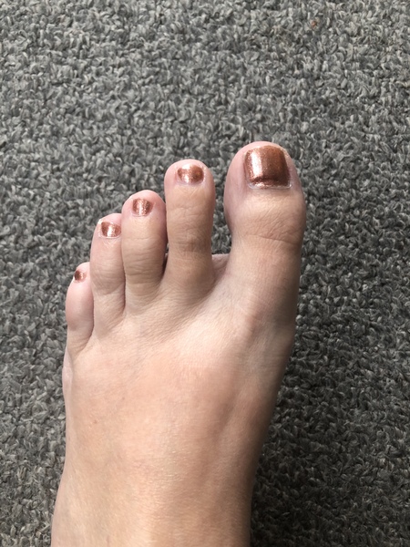 Are white toenails the only 'in' colour right now?