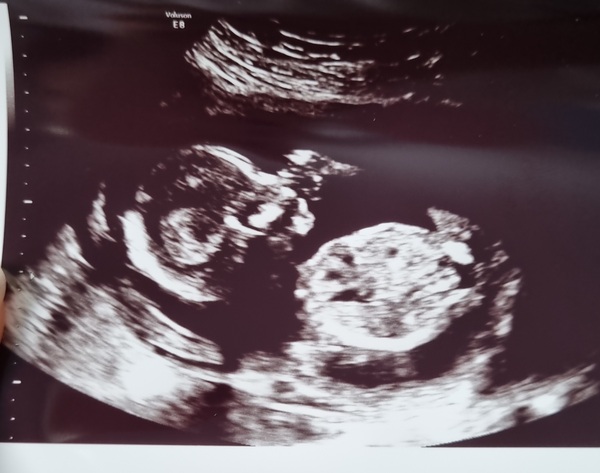 Due February 2022 (thread 3)