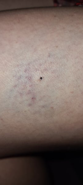 How the fuck do I deal with this