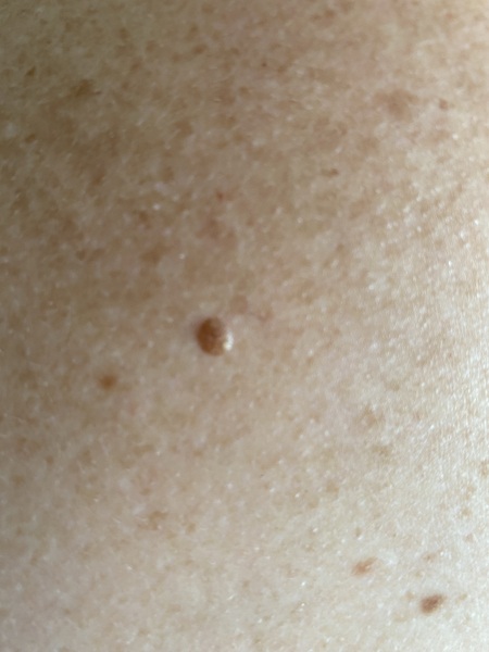 Weird spot