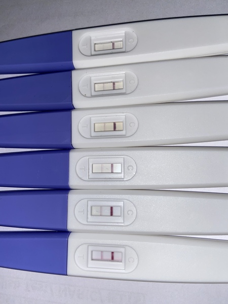 HPT’s getting darker after miscarriage at 5 weeks, ectopic?