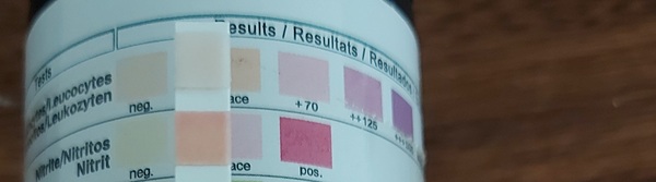 Does this dipstick indicate a UTI